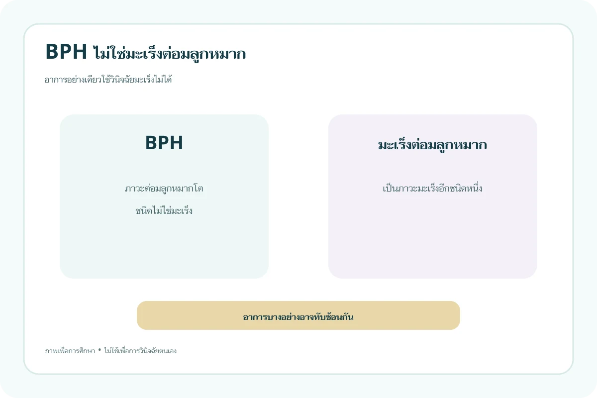 อินโฟกราฟิกเปรียบเทียบแนวคิด BPH กับมะเร็งต่อมลูกหมาก โดยเน้นว่าเป็นคนละภาวะและอาการอาจทับซ้อนกัน