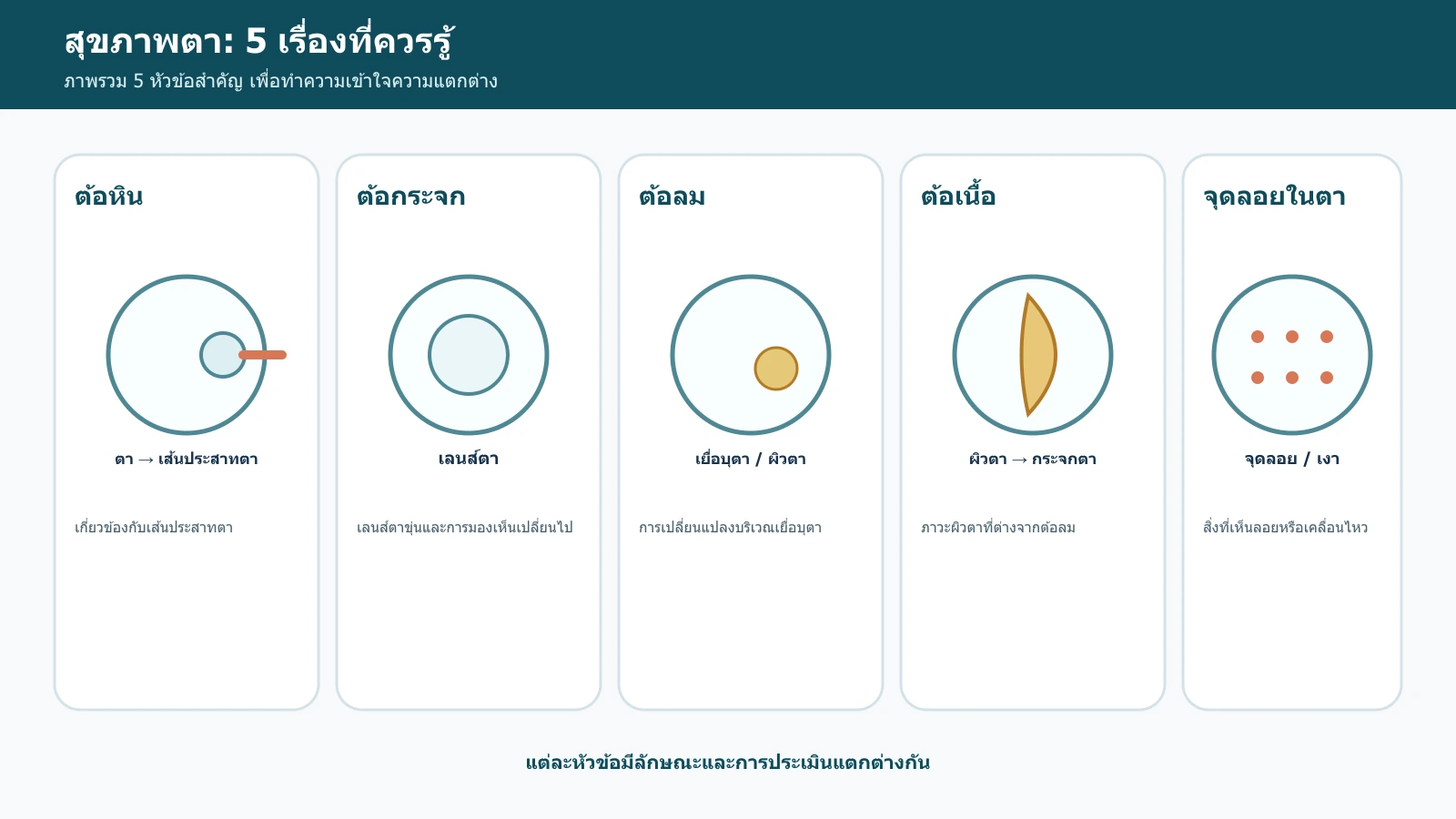 อินโฟกราฟิกภาพรวมความรู้สุขภาพตา 5 หัวข้อ ได้แก่ ต้อหิน ต้อกระจก ต้อลม ต้อเนื้อ และจุดลอยในตา