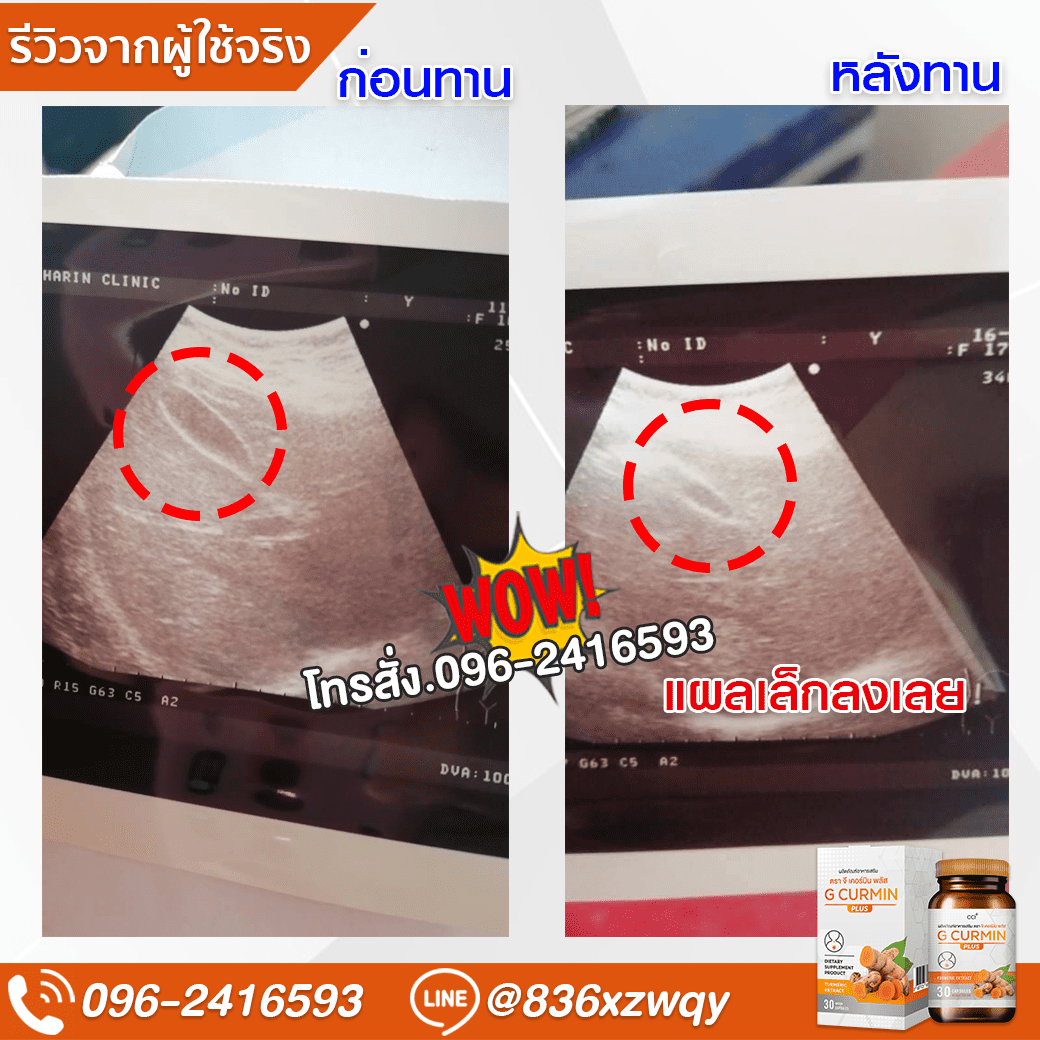 ภาพรีวิว 16 แบบเต็มภาพ